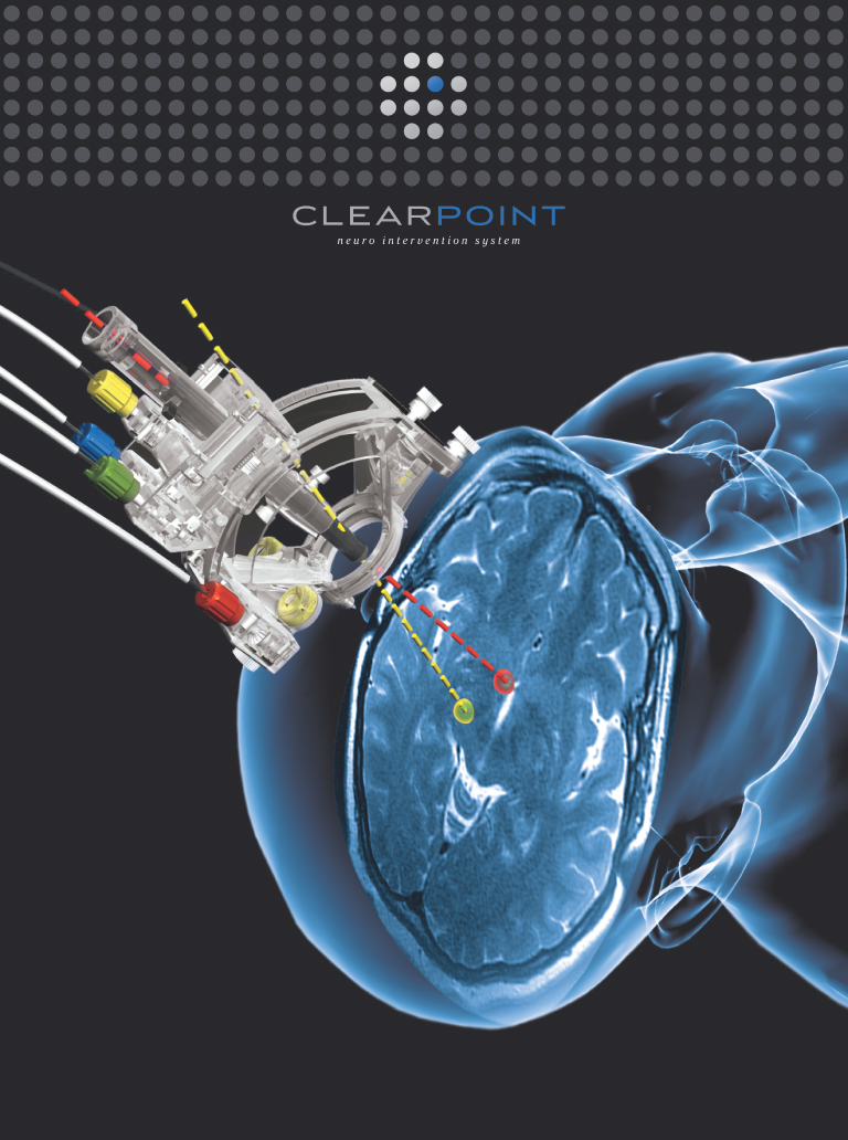 ClearPoint Neuro Announces FDA Clearance and First-in-Human Cases